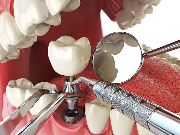 Best Urgent Tooth Repair  in Norwich, NY